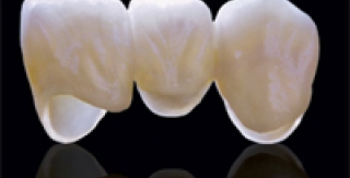 Sứ không kim loại và Sứ quý kim khác các loại sứ thường như thế nào?